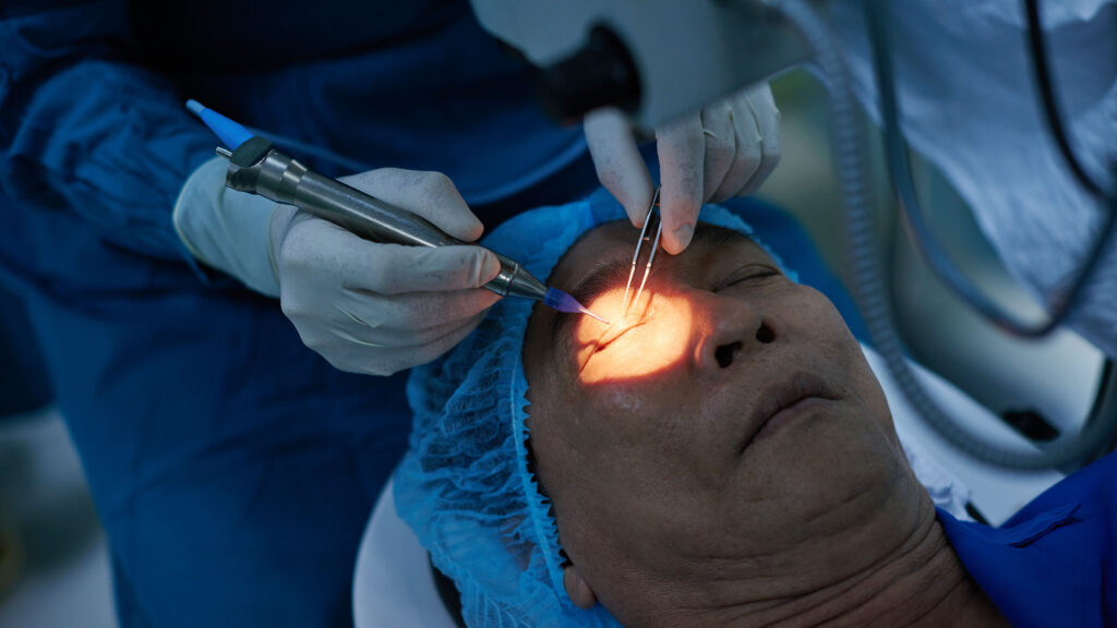 glaucoma surgery